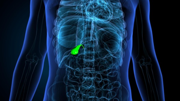 Gallbladder Adenomyomatosis